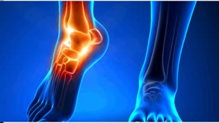 Elite Specialty Care : Foot Injury Treatment  in Elizabeth, NJ