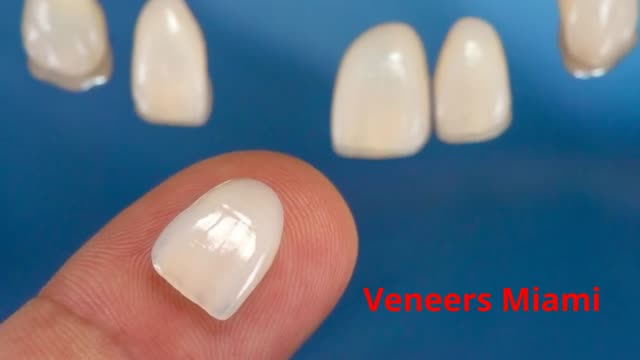 Paya Dental - Veneers in Miami, FL