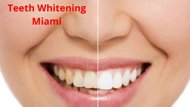 Paya Dental : #1 Teeth Whitening in Miami, FL