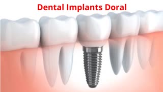 Miami Dental Group - #1 Dental Implants in Doral, FL