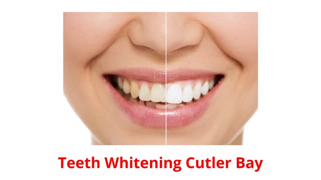 Dr. Lysette González Dental Clinic : Teeth Whitening in Cutler Bay, FL
