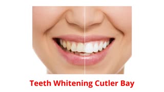 Dr. Lysette González Dental Clinic : Teeth Whitening in Cutler Bay, FL