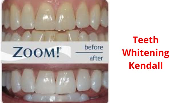 Miami Dental Group - #1 Teeth Whitening in Kendall, FL