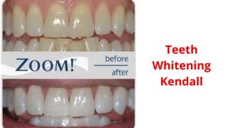 Miami Dental Group - #1 Teeth Whitening in Kendall, FL