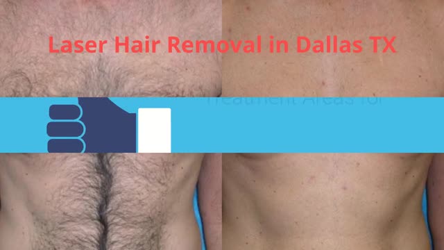 Body Lounge Park Cities : Laser Hair Removal in Dallas, TX