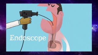 The surprising cause of stomach ulcers