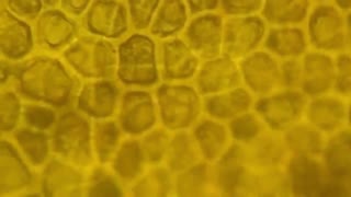 15 Things You DON'T Want To See Under A Microscope!