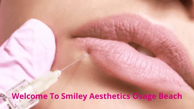 Smiley Aesthetics - Dermal Filler in Osage Beach, MO