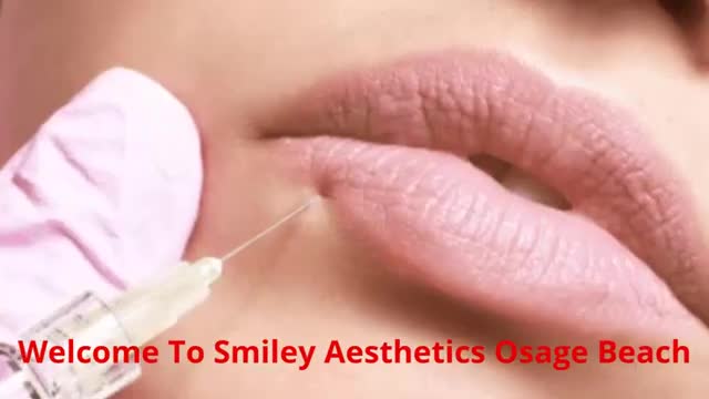 Smiley Aesthetics Dermal Filler Clinic in Osage Beach, MO