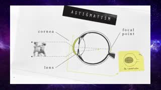 How does laser eye surgery work?