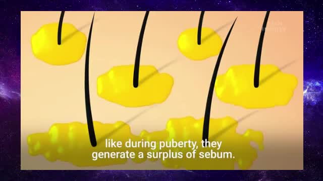 What's Inside A Pimple?