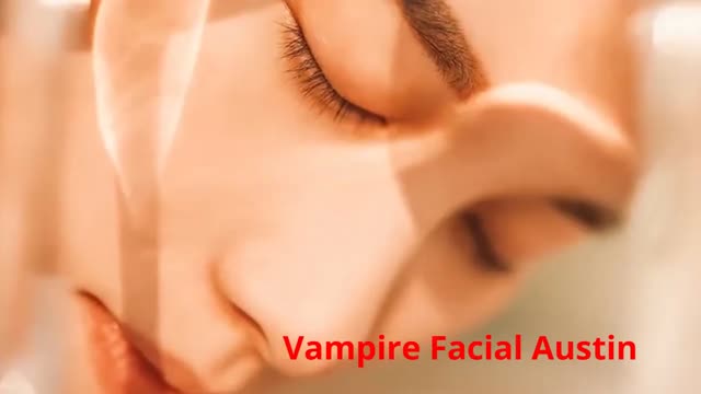 W Aesthetics : Vampire Facial in Austin, TX