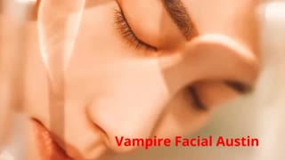 W Aesthetics : Vampire Facial in Austin, TX
