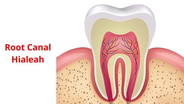 Paya Dental - Root Canal in Hialeah, FL