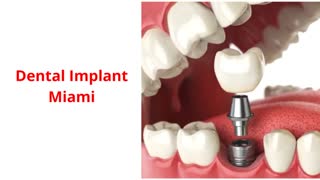 DB Dental Care : Dental Implant in Miami, FL : 33165